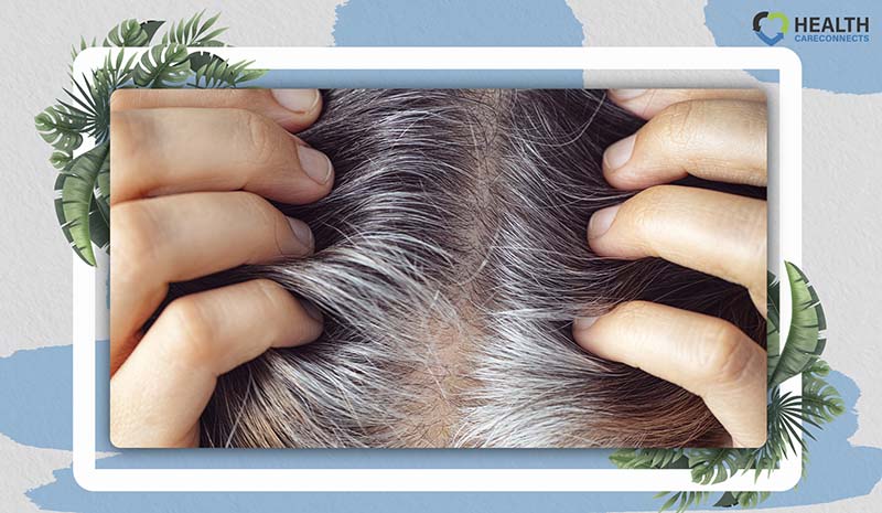 Can Collagen Cause Hair Loss 