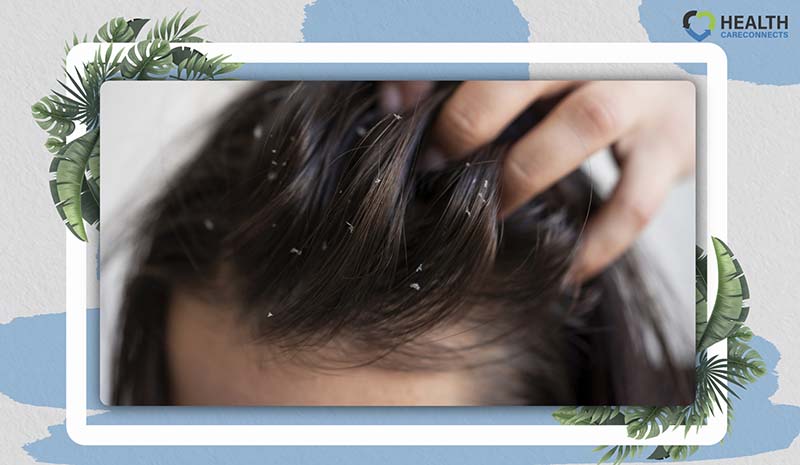 Is Sesame Oil Good for Your Hair